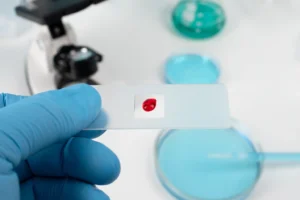 What is Hemoglobin A1C?