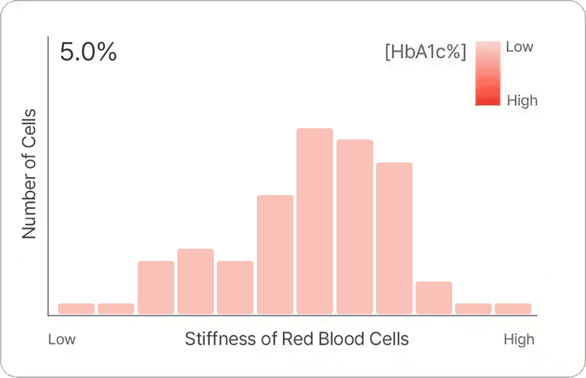 OBM rapid A1c analyzes the deformability distributions of red blood cells in the capillary blood samples. In the distribution data, HbA1c level is inversely correlated with red blood cell deformability. *This study was approved by the Institutional Review Board (IRB) of Orange Biomed Ltd., Co (2022-0594-007).